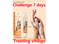 vitiligo-ointment-remove-ringworm-ship-mart-03000479274-small-0