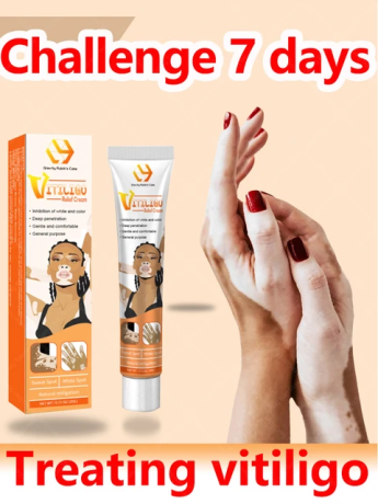 vitiligo-ointment-remove-ringworm-ship-mart-03000479274-big-0